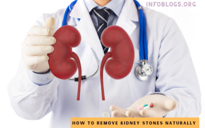 How to remove kidney stones naturally